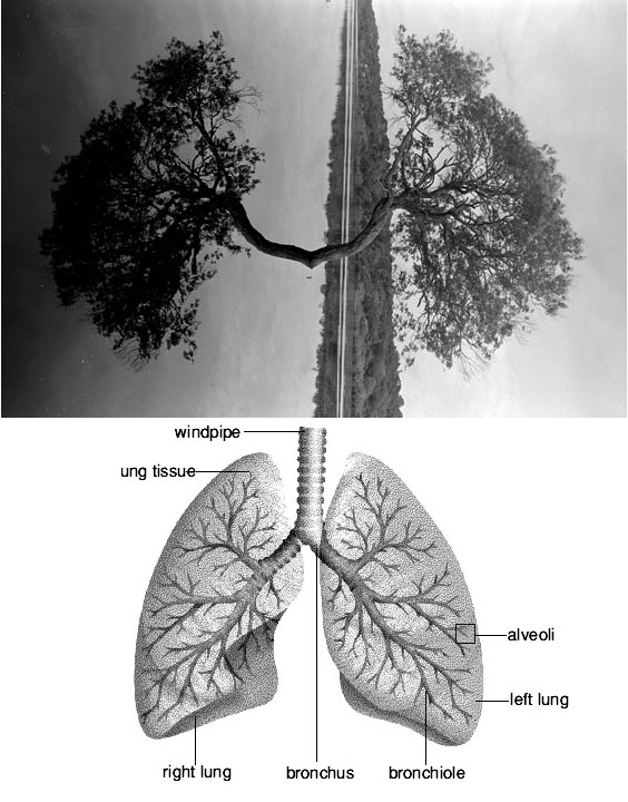 Дерево легкие города. Легкие дерево. Дерево в лёгких. Дерево лёгкого человека. Дерево в лёгких человека.